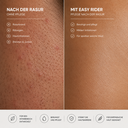 Vorher-Nachher-Vergleich nach der Intimrasur: gereizte Haut mit Rasurbrand und Rötungen neben beruhigter, gepflegter Haut mit Easy Rider After-Shave-Öl.